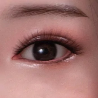 Muttermal unter dem Auge
