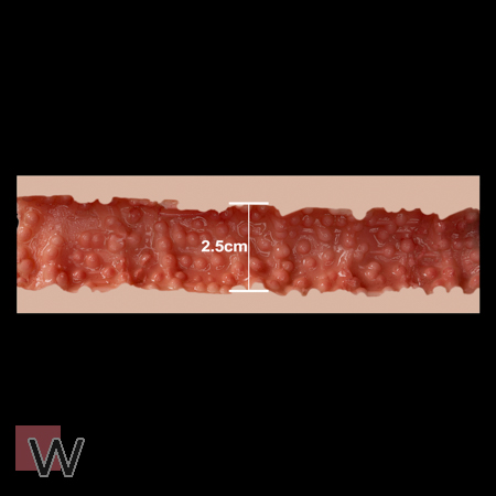 #1 - 2,5 cm