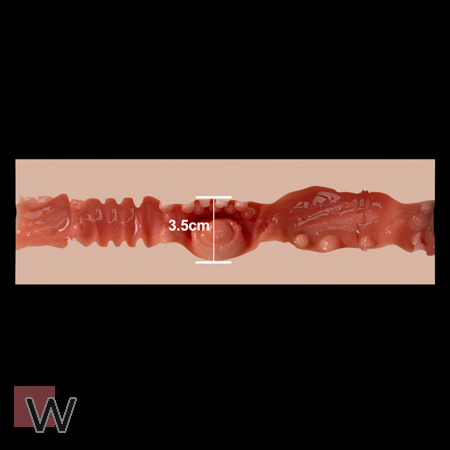 #2 - 3,5 cm