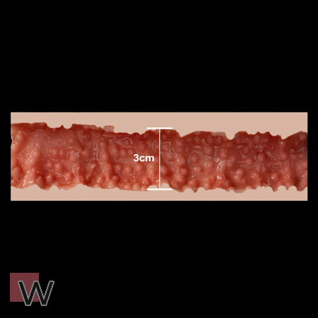 #2 - 3 cm