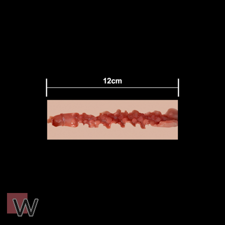 #1 - 12 cm