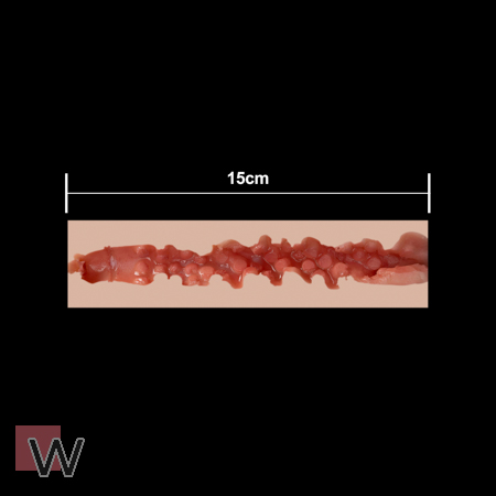 #2 - 15 cm