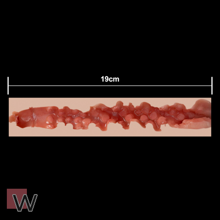 #3 - 19 cm