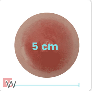 5 cm