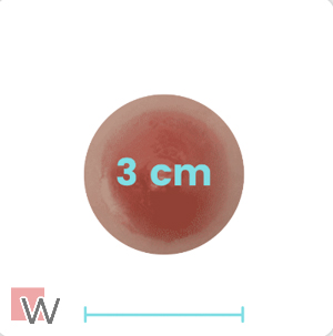 3 cm