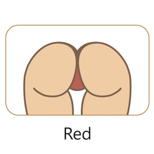 Rot
