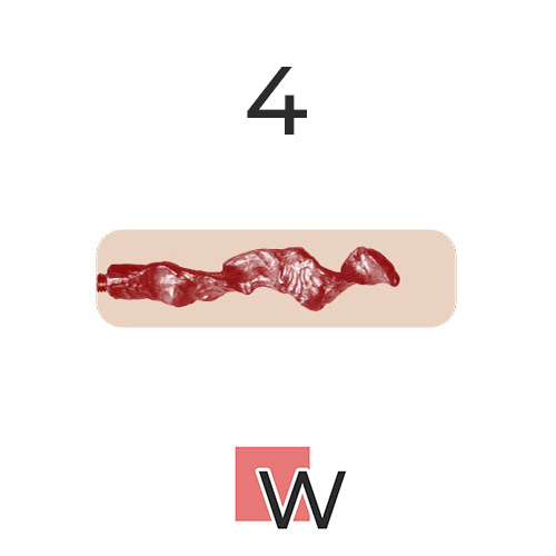 #4