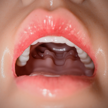 Beweglicher Kiefer (ROS)