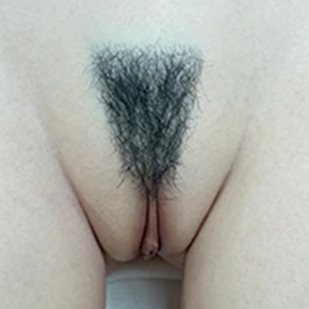 #2
