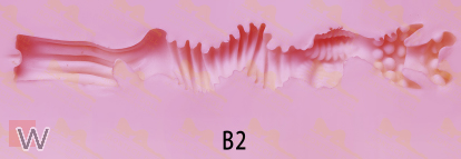 B2