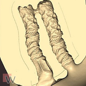 Fest verbaut - Verbundene Kanäle