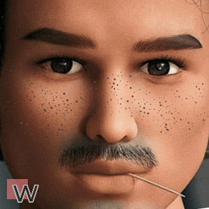 Sommersprossen (59,00 €)