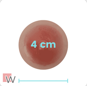 4 cm