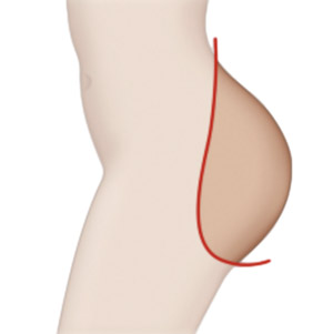 Hintern (85,00€) KOSTENLOS